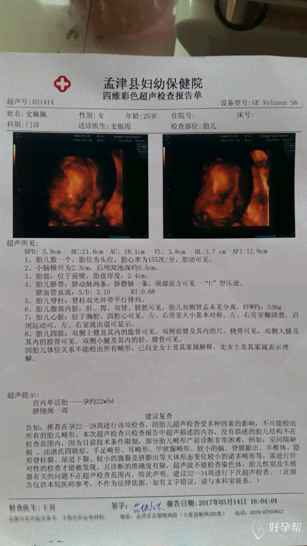 四维照片跟真婴儿生成器对比：区别、转换真人照片及宝宝出生照片晒晒