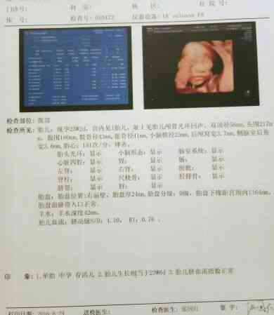 四维彩超ai免费生成官网 - 在线查询与