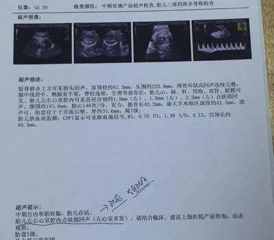 全面盘点：主流四维AI彩超照片生成软件及功能特点解析