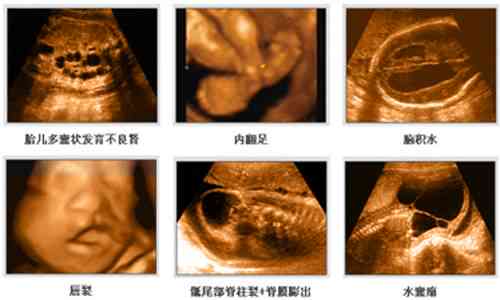 免费四维彩超宝宝照片生成教程，抖音专属宝宝照片制作攻略