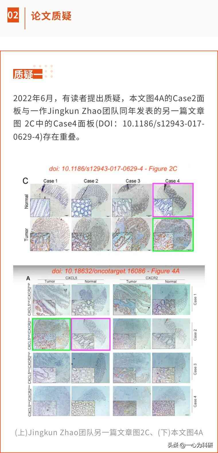 ai论文生成器：免费使用、防重复选择、优质软件推荐与版探讨