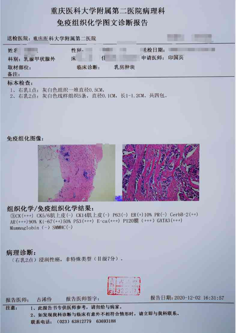 如何解读胃镜病理报告单及其结果