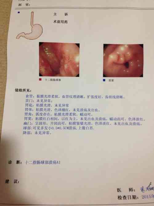 活检确诊攻略：医生教你如何看懂胃镜病理报告与胃癌诊断结果