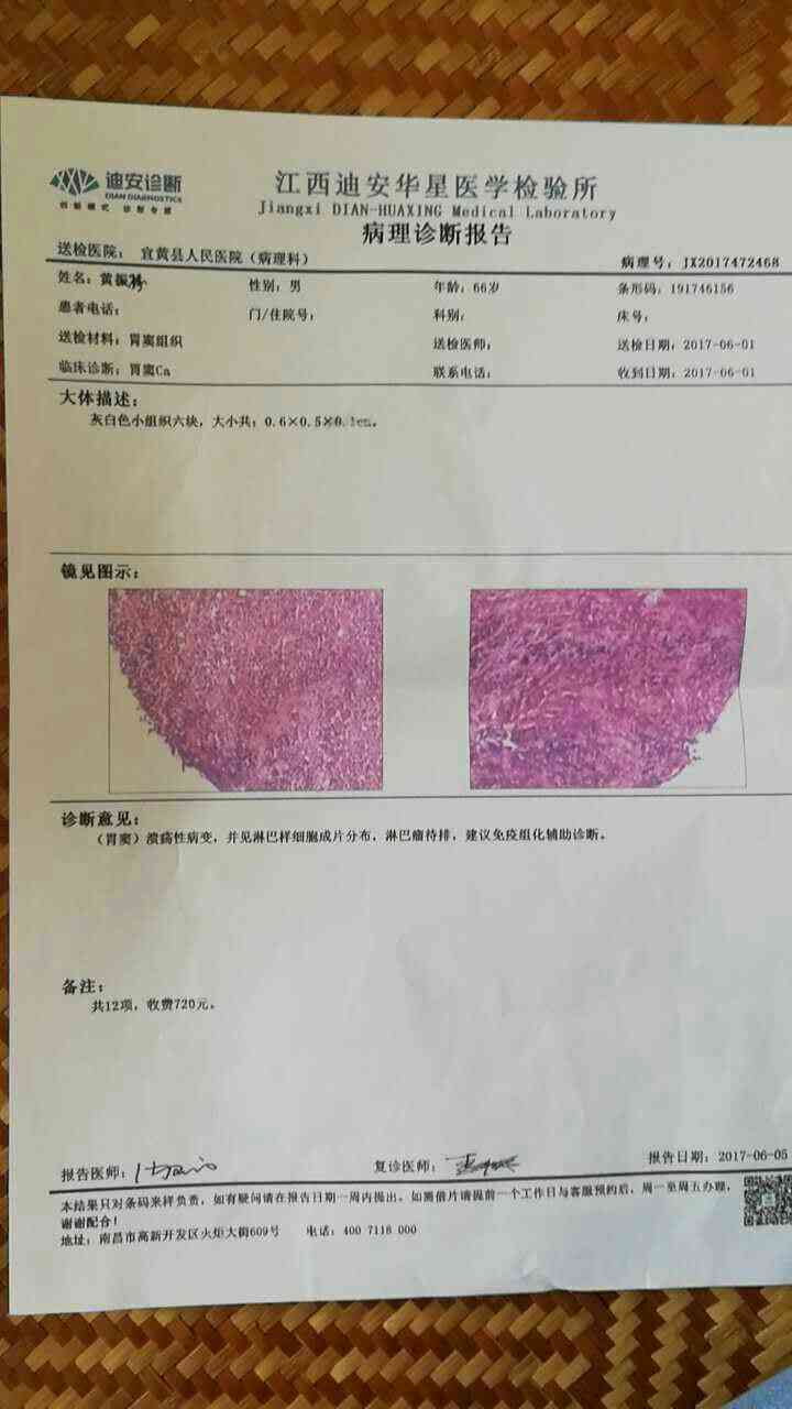 活检确诊攻略：医生教你如何看懂胃镜病理报告与胃癌诊断结果