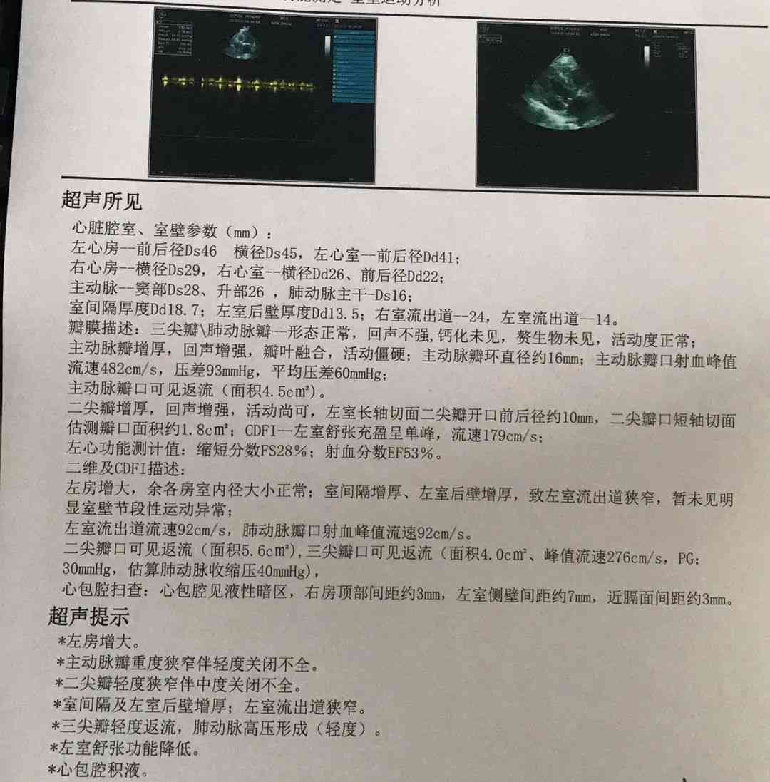 心脏超声报告单常见英文缩写及全称解读：全面解析超声心动图术语与含义