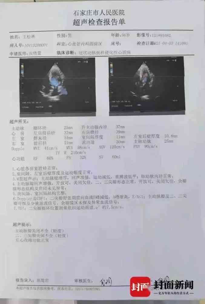 心脏超声报告单怎么看：全面解读结果与要点精髓