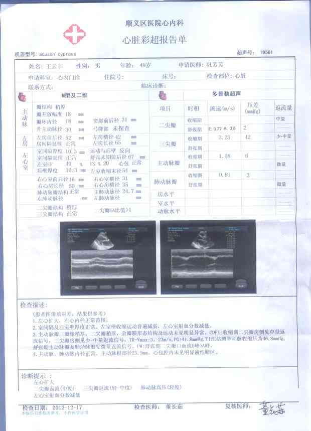 心脏超声报告单AI