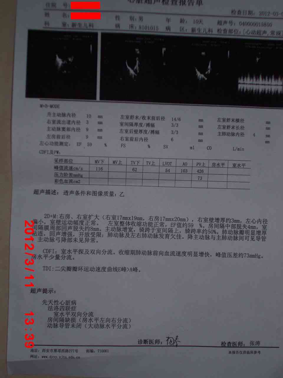 心脏超声报告单AI