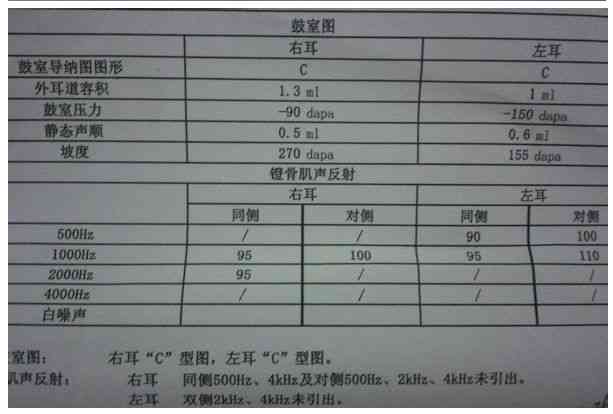 听力报告显示a无中耳问题，抽出积液后al与ac值分析