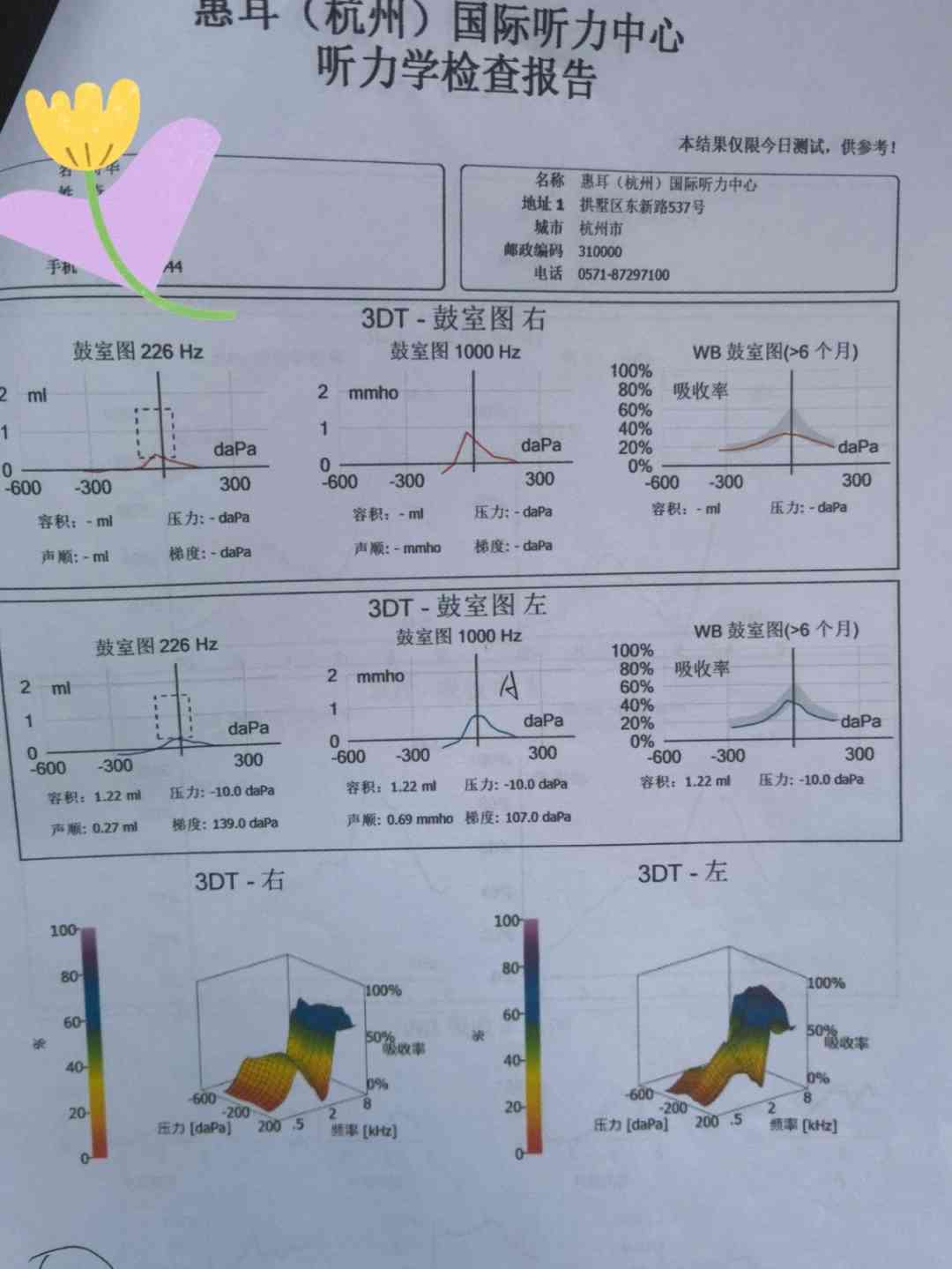 听力报告显示a无中耳问题，抽出积液后al与ac值分析