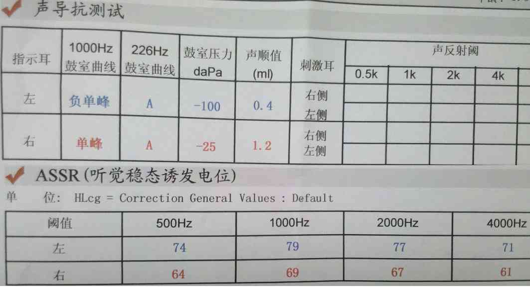 如何看懂听力检测报告单中字母代表的含义与测试结果