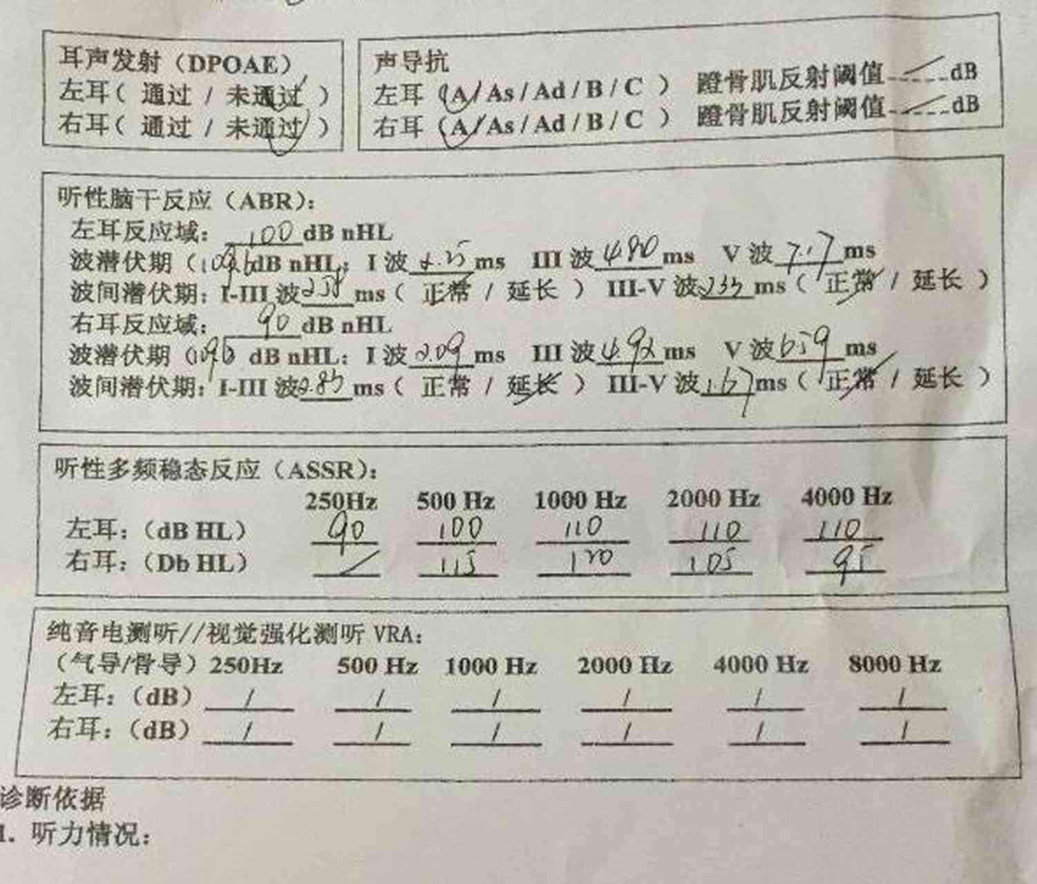 如何看懂听力检测报告单中字母代表的含义与测试结果