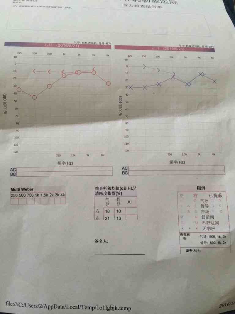 如何看懂听力检测报告单中字母代表的含义与测试结果