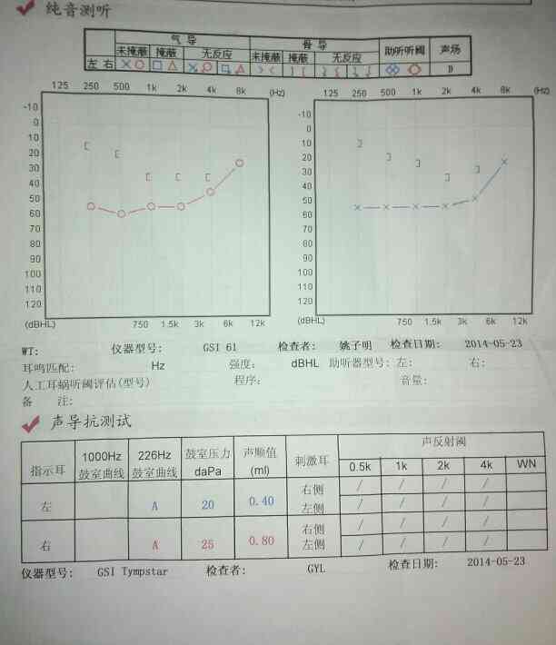 如何看懂听力检测报告单中字母代表的含义与测试结果