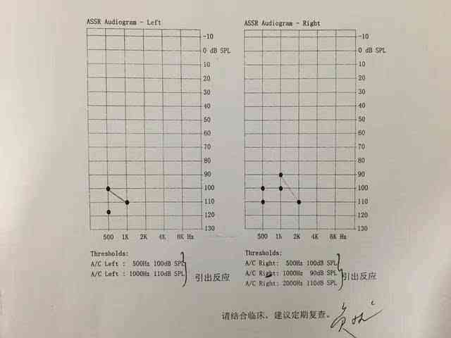 听力检测报告单ai代表什么