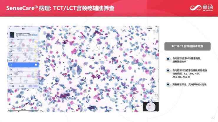 全方位赋能医学研究：AI智能分析与辅助写作革新医疗学术创作体验