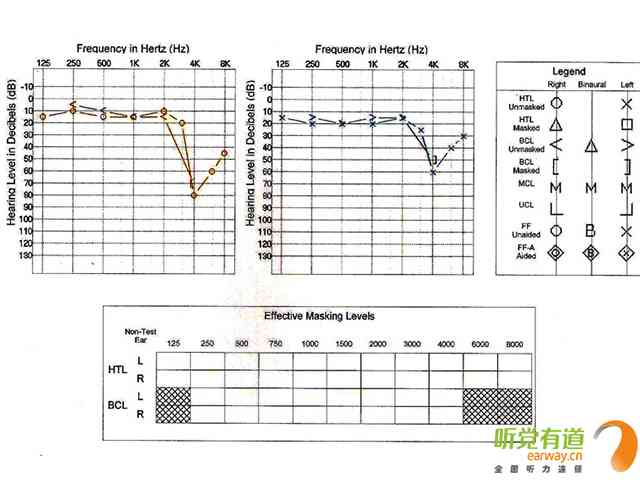 纯音测听报告解读-纯音测听报告解读图片