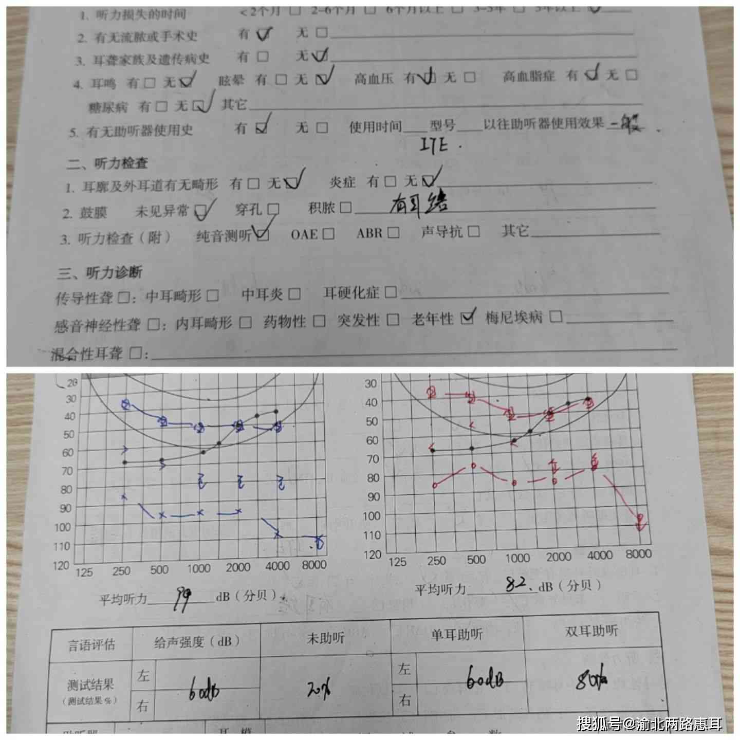 全面听力健评估：纯音测听检测报告与解读指南