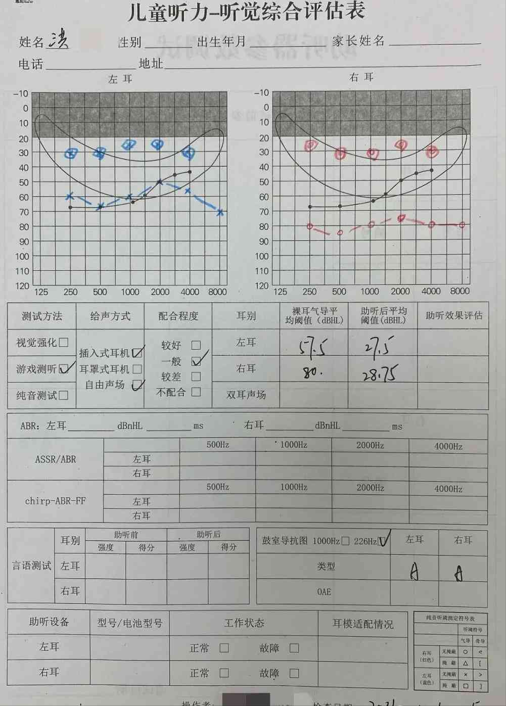 纯音听阈测试AI：听力正常值范围与医生判断的多少标准