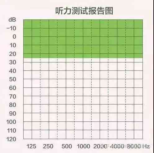 纯音测听报告ai是什么意思