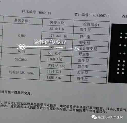 听力筛查未通过，测试结果显示健问题需医生查没