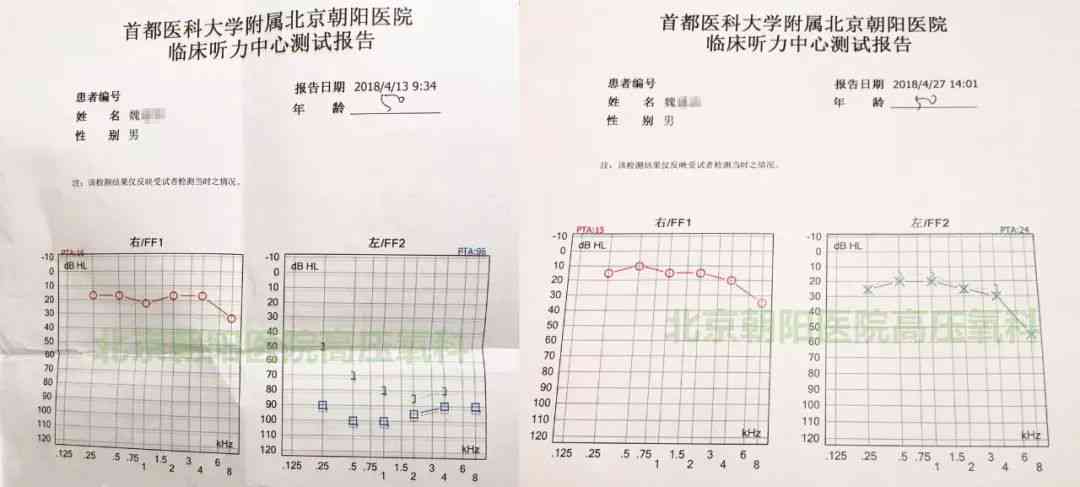 听力测试报告ai没有