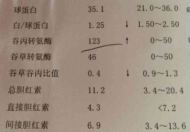 体检报告单解读：全面总结、PPT制作、解读方法及意义，挂号科室指南