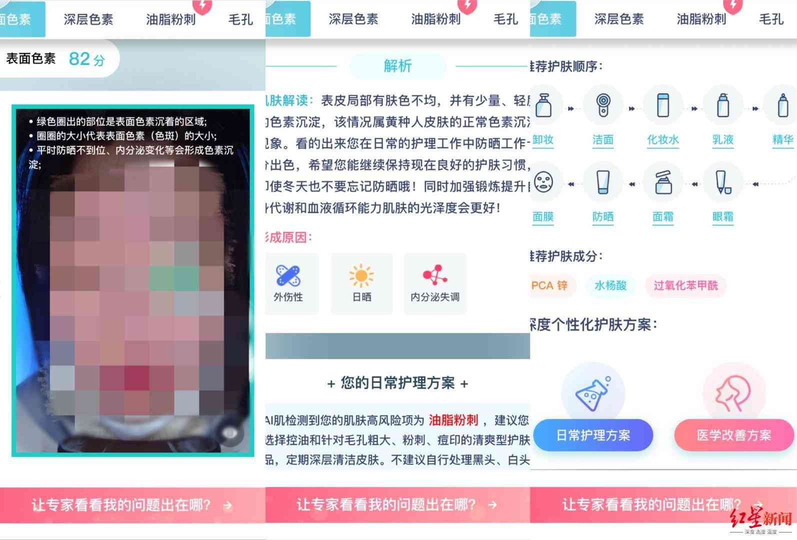 肌肤AI检测报告