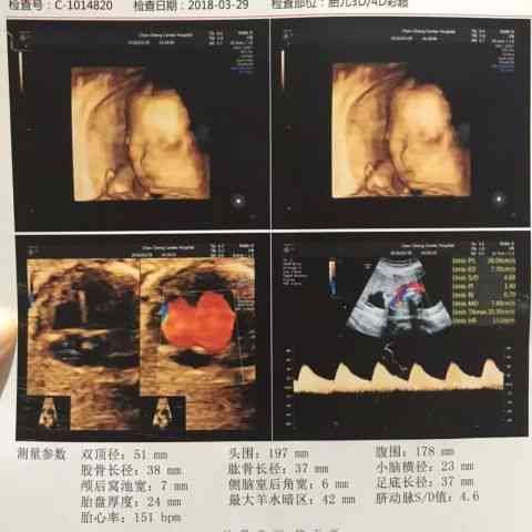 生命初现：宝宝四维照片到了，朋友，一起感受这份彩超带来的独特文案