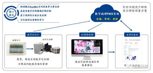 AI智能检测系统管理方法、与CCD检测系统区别、血管识别能力及项目价格评估