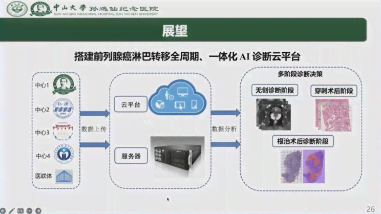 智能AI技术助力相似度精准对比分析