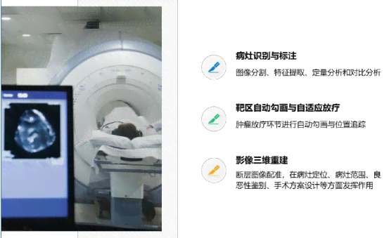 迈瑞斯s10睡眠报告中总ai