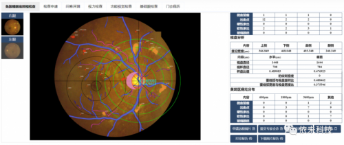 AI眼底相机诊断报告查看指南：如何在多平台快速获取与解读眼底健报告