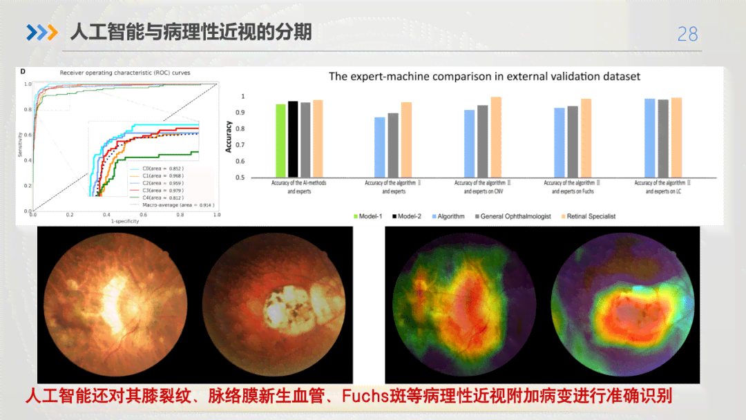 ai眼底照相机检查是什么：优势与弊端分析及airdoc应用探究