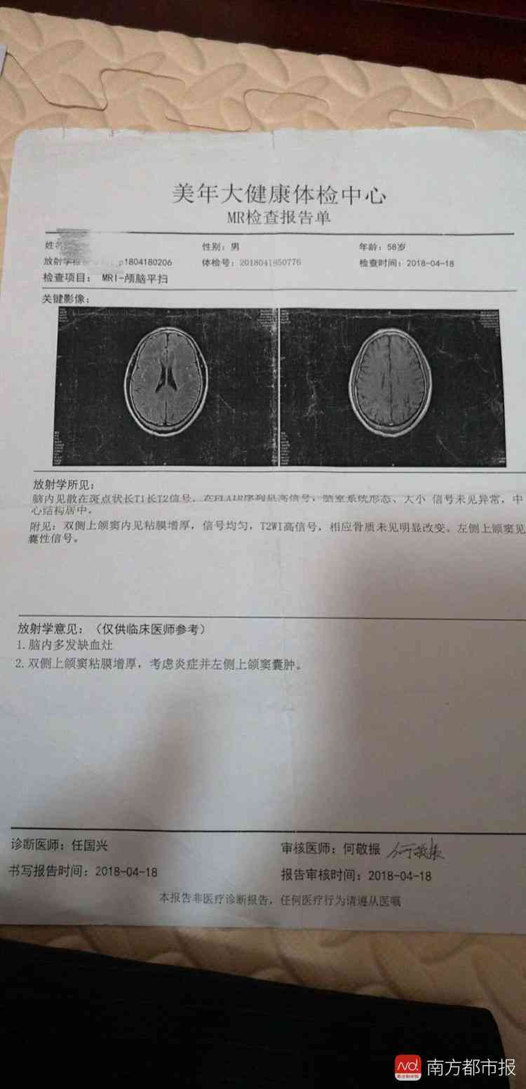 美年大健体检报告ai解读：、如何查看及报告单样式详解