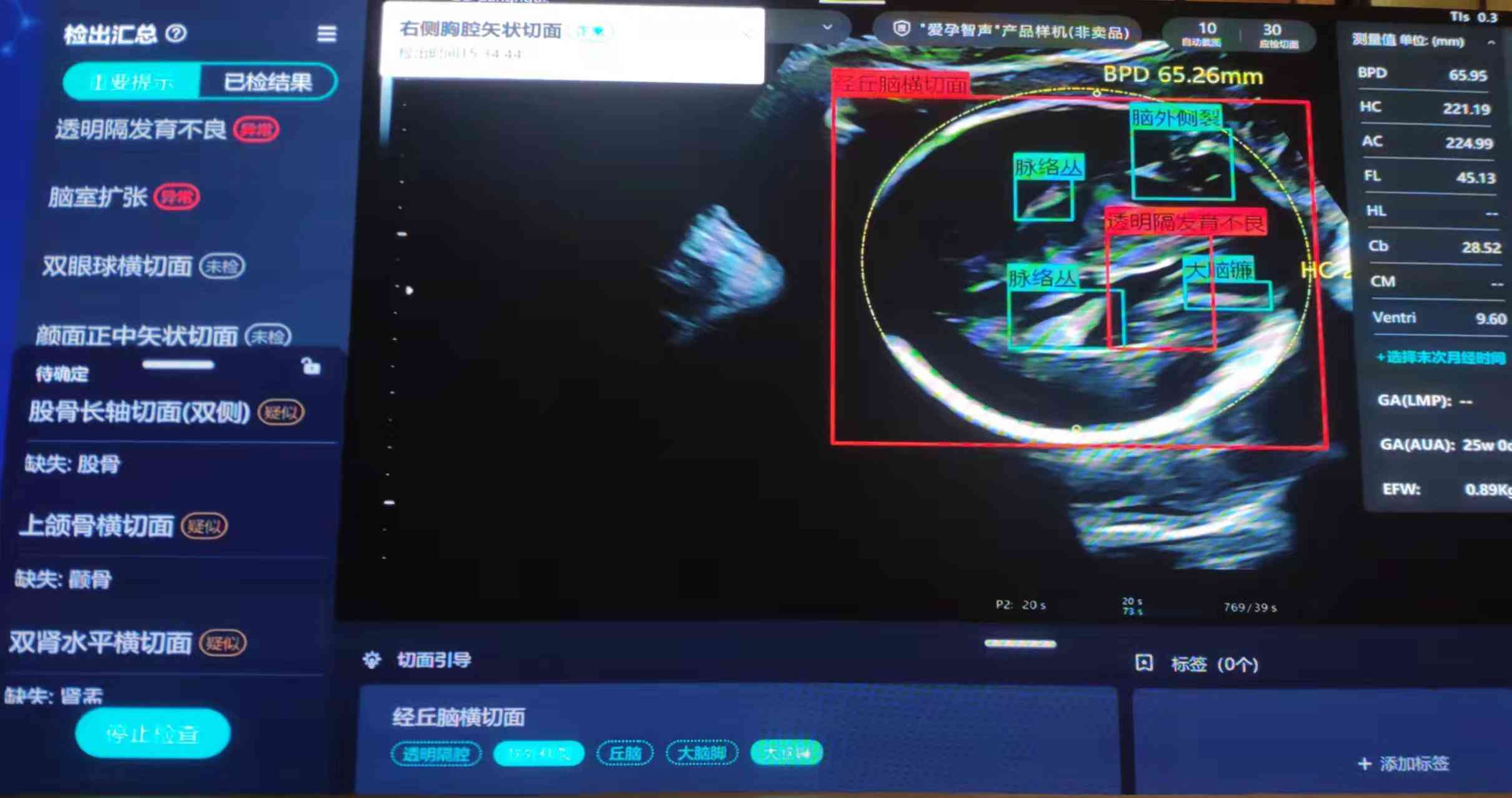 全面解读AI医疗诊断：发展趋势、应用案例与未来挑战分析报告