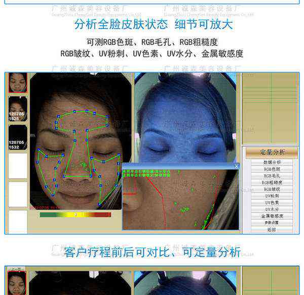 '智能皮肤分析系统——AI肌肤深度检测报告单'