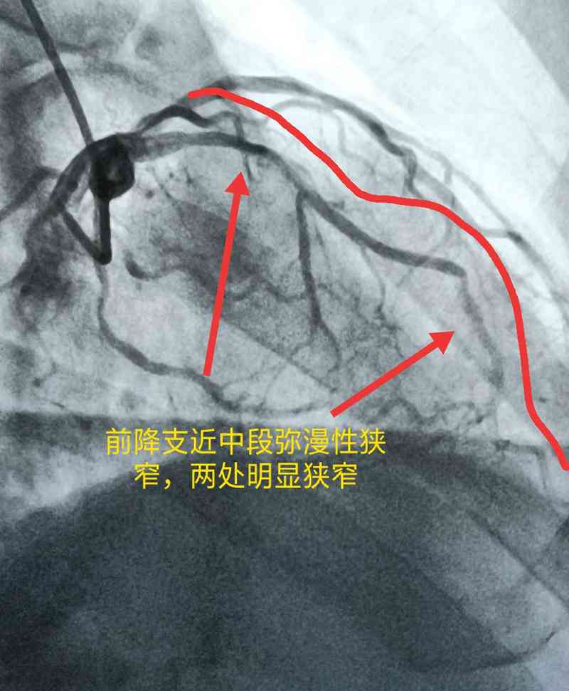 全面解析血液检测报告：深入解读各项指标与临床意义