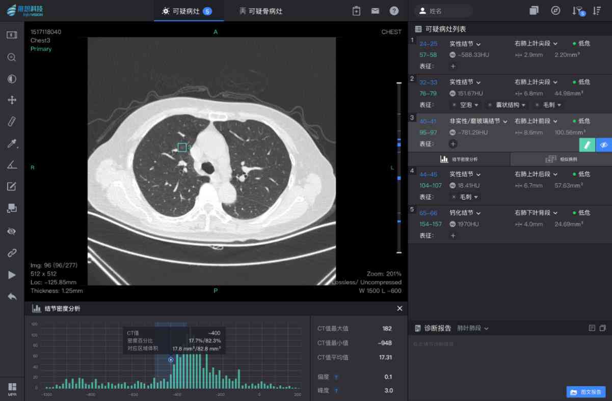 CT报告AI显示是什么意思