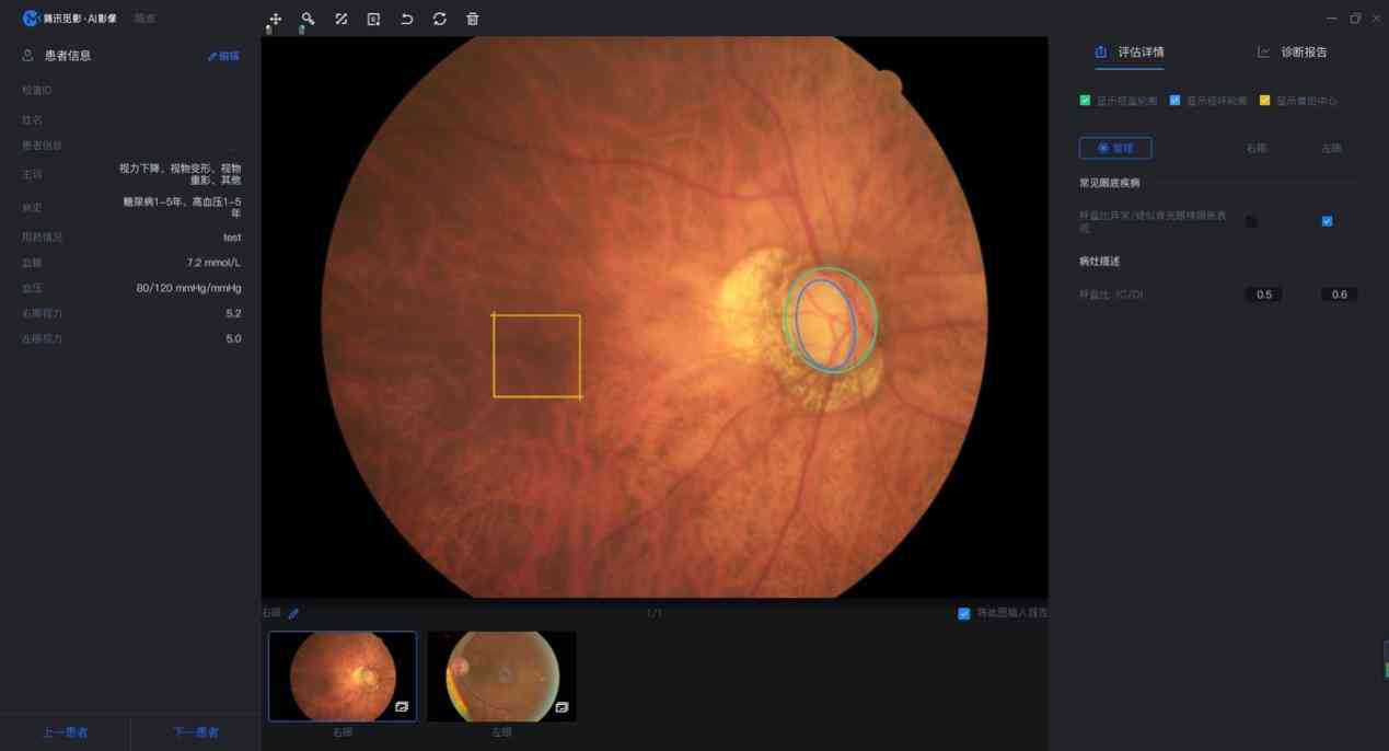 《人工智能助力软件开发：AI辅助开发详细报告撰写指南》