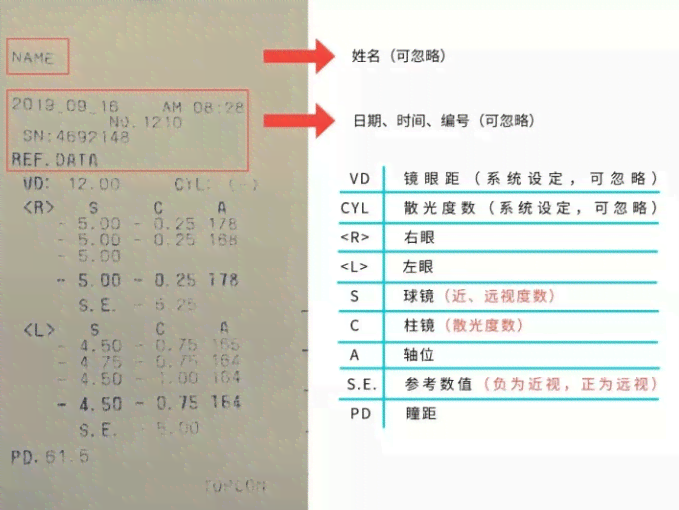 听力检查报告AI是什么意思