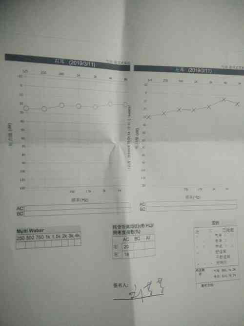 听力报告ai是啥意思：含义及表示解析