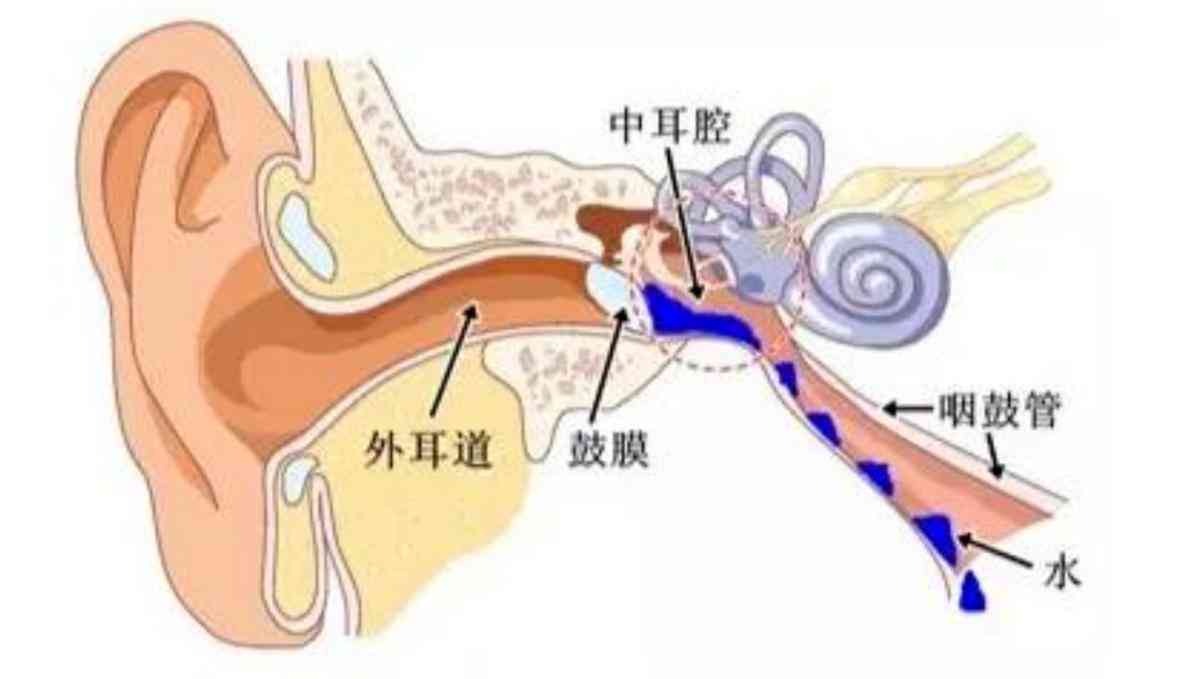 听力报告显示a无中耳问题，抽出积液后al、ac含义解析