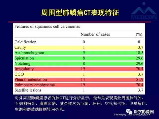 肺ct报告的解读：癌症指标、多条高密度影、英文名称含义及CT值分析