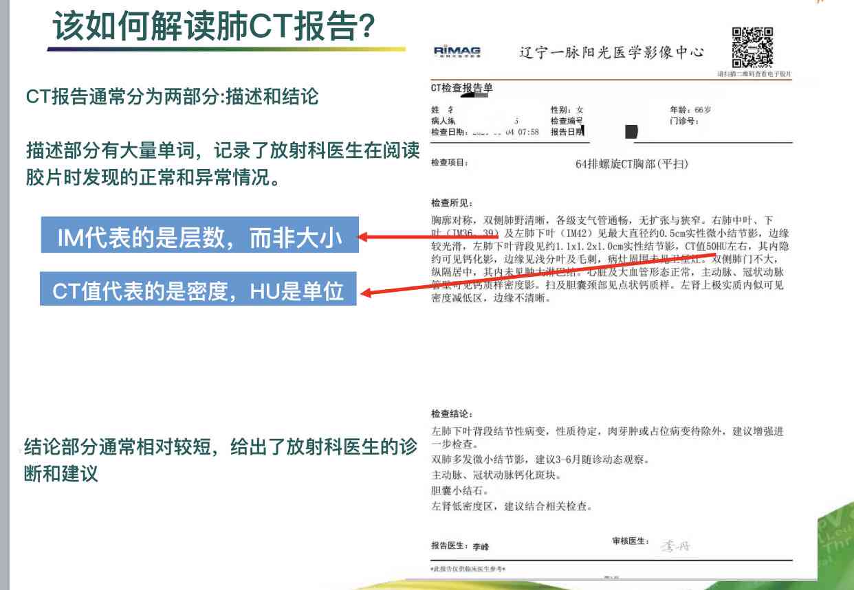 肺ct报告的解读：癌症指标、多条高密度影、英文名称含义及CT值分析