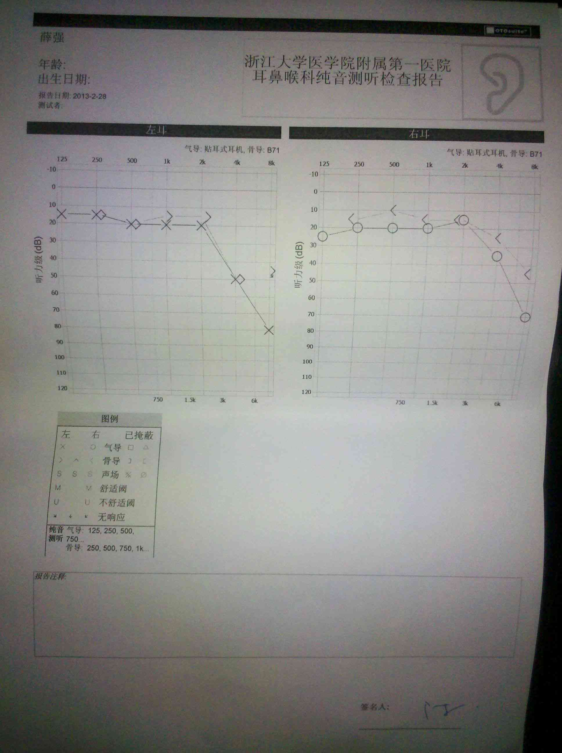 '基于AI技术的单纯音听均值听力测试报告分析'