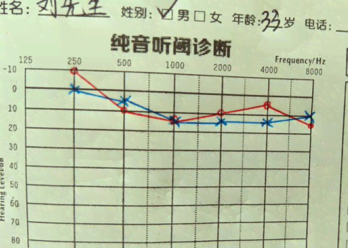 '基于AI技术的单纯音听均值听力测试报告分析'