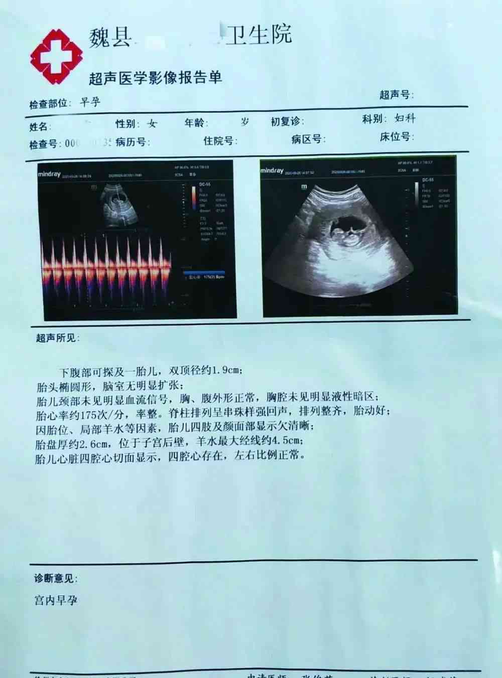 工人医院报告单查询系统：在线查看检验报告、诊断结果及健信息