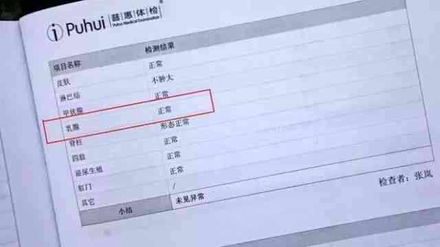 HIV检测解读：如何正确查看体检报告中的HIV结果