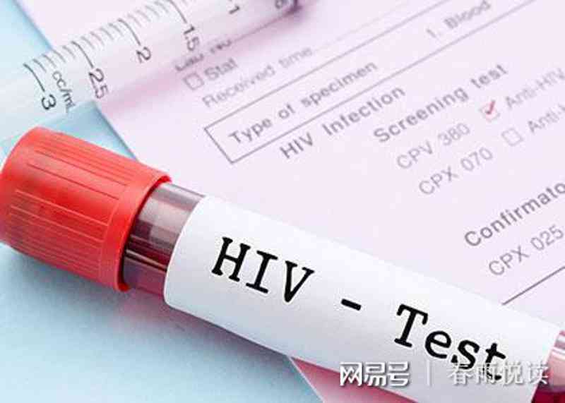 HIV检测解读：如何正确查看体检报告中的HIV结果